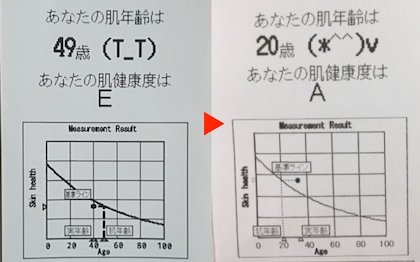肌年齢の変化
