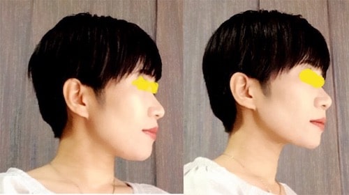 th_mmtomo-min